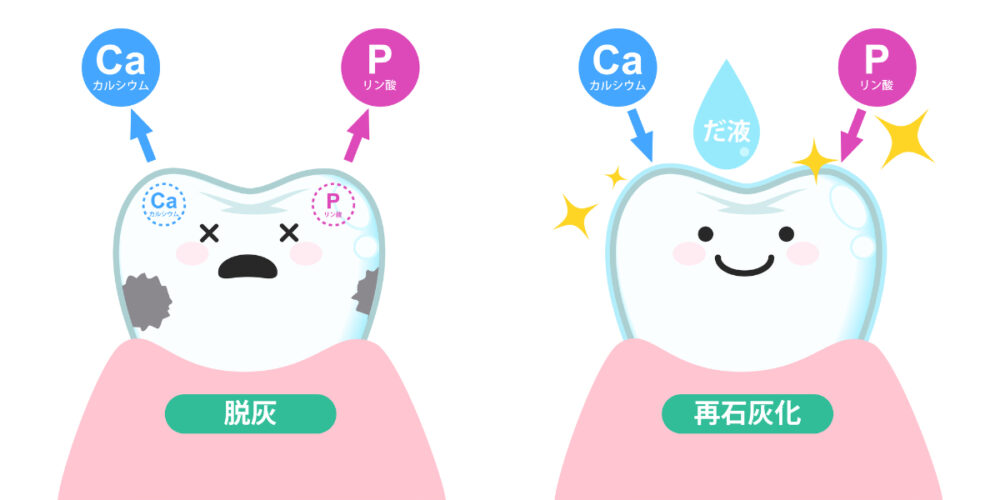 フッ素とは？なぜ歯に良いのか｜瀬戸市の歯医者「瀬戸歯科」
